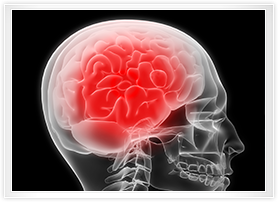 뇌 사진