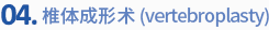 04. 椎体成形术(vertebroplasty)