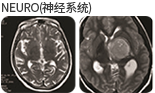 NEURO(신경계) 촬영 사진