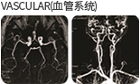 VASCULAR(혈관계) 촬영 사진