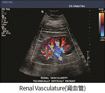 Renal Vasculature (신장혈류)