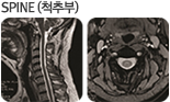 SPINE(ôߺ) Կ 