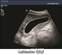 Gallbladder(㳶)