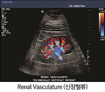 Renal Vasculature ()